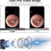 Smart Visual Ear Cleaner