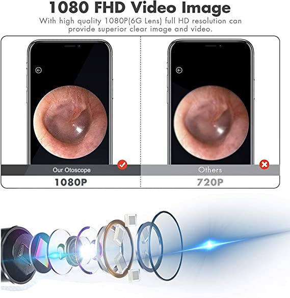 Smart Visual Ear Cleaner